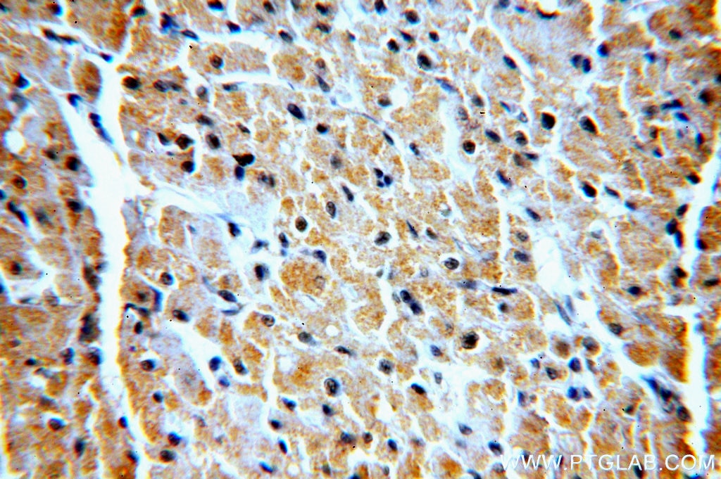 Immunohistochemistry (IHC) staining of human heart tissue using VPS34 Polyclonal antibody (13723-1-AP)