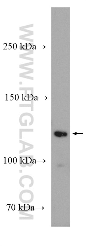 Western Blot (WB) analysis of COLO 320 cells using PI3 Kinase p110 Alpha Polyclonal antibody (20583-1-AP)