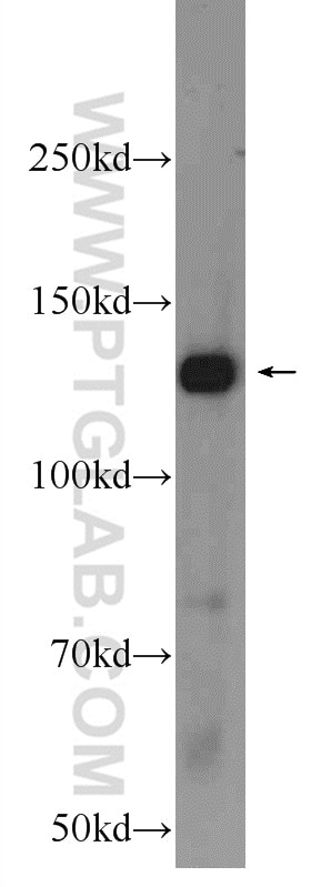 Western Blot (WB) analysis of HeLa cells using PI3 Kinase p110 Alpha Polyclonal antibody (20583-1-AP)