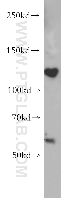 Western Blot (WB) analysis of COLO 320 cells using PI3 Kinase p110 Alpha Polyclonal antibody (20583-1-AP)