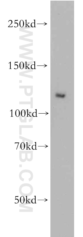 Western Blot (WB) analysis of HeLa cells using PI3 Kinase p110 Alpha Polyclonal antibody (20583-1-AP)