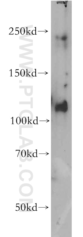 Western Blot (WB) analysis of HeLa cells using PI3 Kinase p110 Alpha Polyclonal antibody (20583-1-AP)
