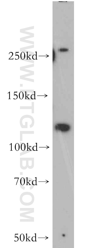 Western Blot (WB) analysis of A431 cells using PI3 Kinase p110 Alpha Polyclonal antibody (20583-1-AP)