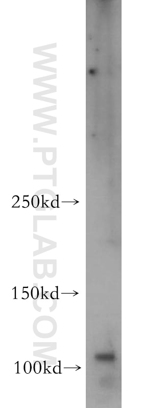 Western Blot (WB) analysis of mouse liver tissue using PI3 Kinase p110 Alpha Polyclonal antibody (20583-1-AP)