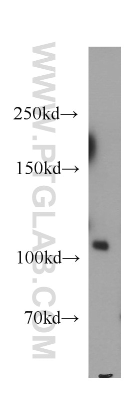 Western Blot (WB) analysis of human brain tissue using PI3 Kinase p110 Alpha Polyclonal antibody (21890-1-AP)