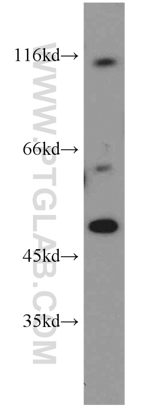 Western Blot (WB) analysis of Jurkat cells using PI3 Kinase p110 Alpha Polyclonal antibody (21890-1-AP)
