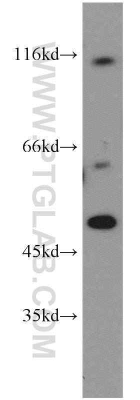 WB analysis of Jurkat using 21890-1-AP
