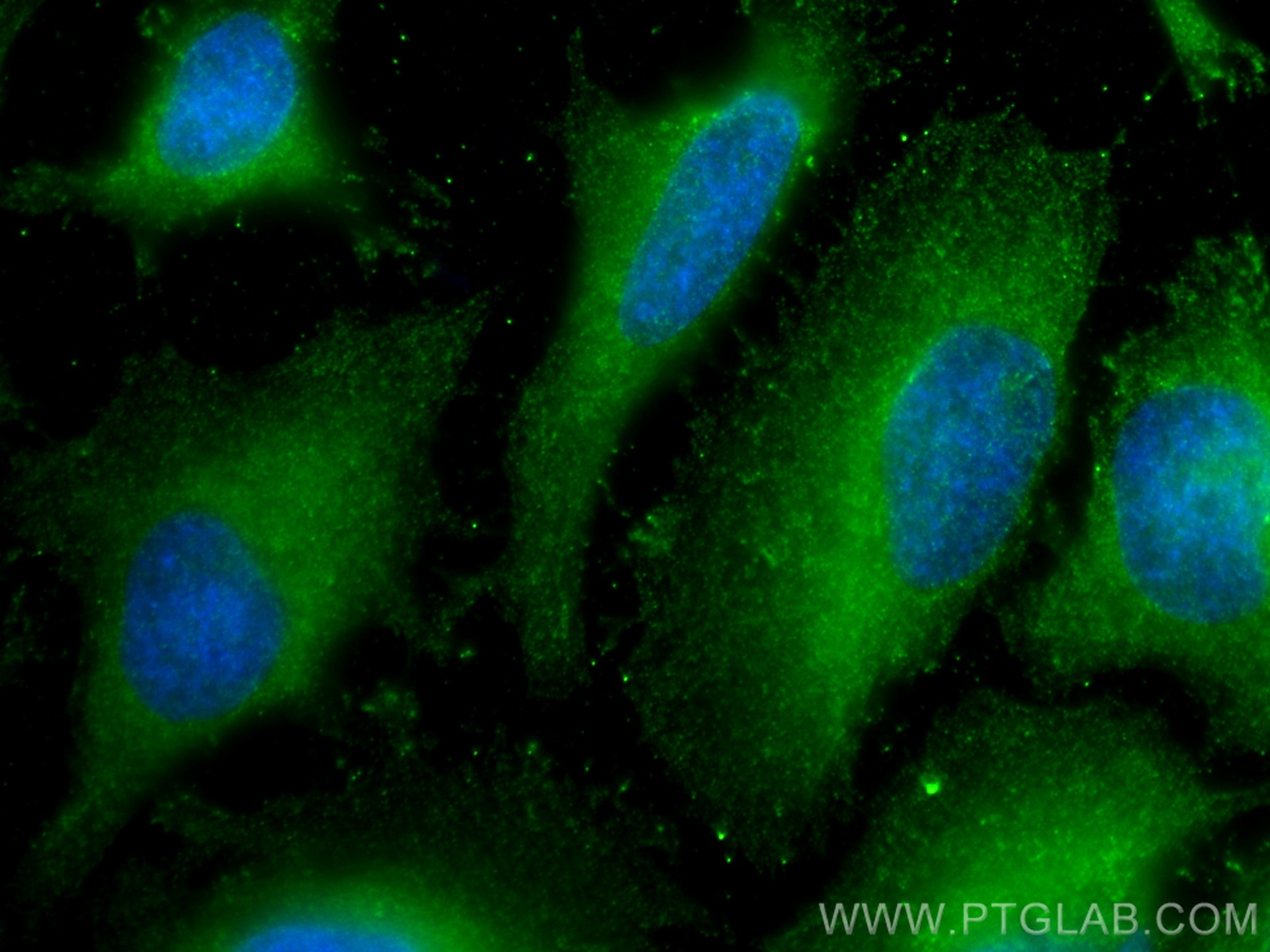 Immunofluorescence (IF) / fluorescent staining of HeLa cells using PI3 Kinase p110 Alpha Monoclonal antibody (67071-1-Ig)