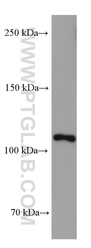Western Blot (WB) analysis of pig brain tissue using PI3 Kinase p110 Alpha Monoclonal antibody (67071-1-Ig)