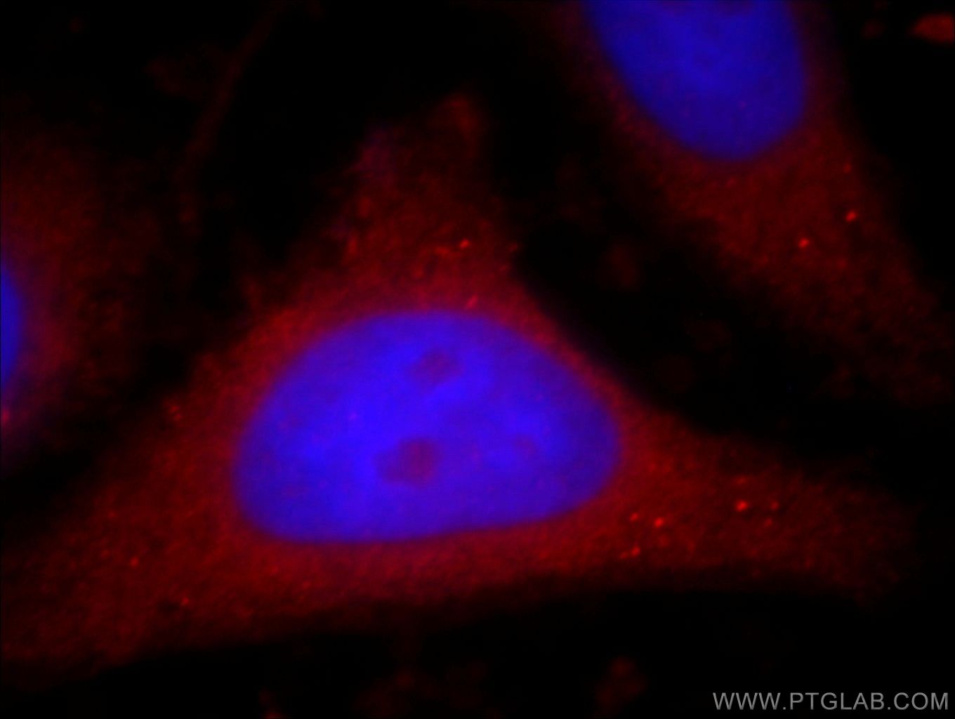 PI3 Kinase p110 Beta