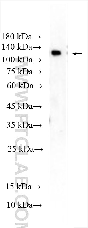 Western Blot (WB) analysis of rat liver tissue using PI3 Kinase p110 Beta Polyclonal antibody (20584-1-AP)