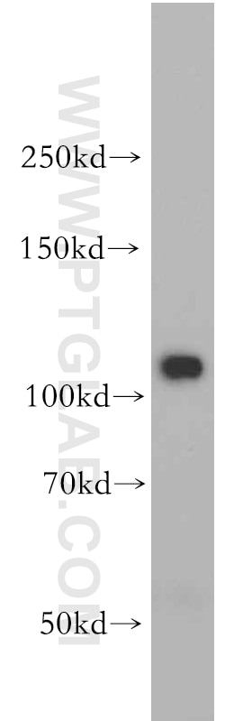 PI3 Kinase p110 Beta Polyclonal antibody
