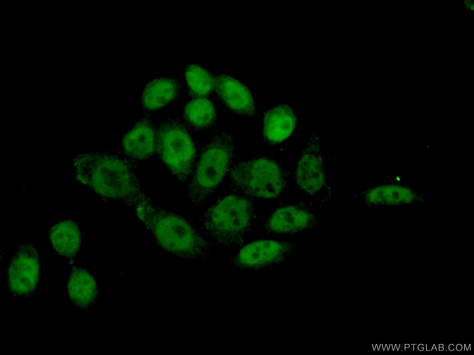 Immunofluorescence (IF) / fluorescent staining of HeLa cells using PI3 Kinase p110 Beta Polyclonal antibody (21739-1-AP)