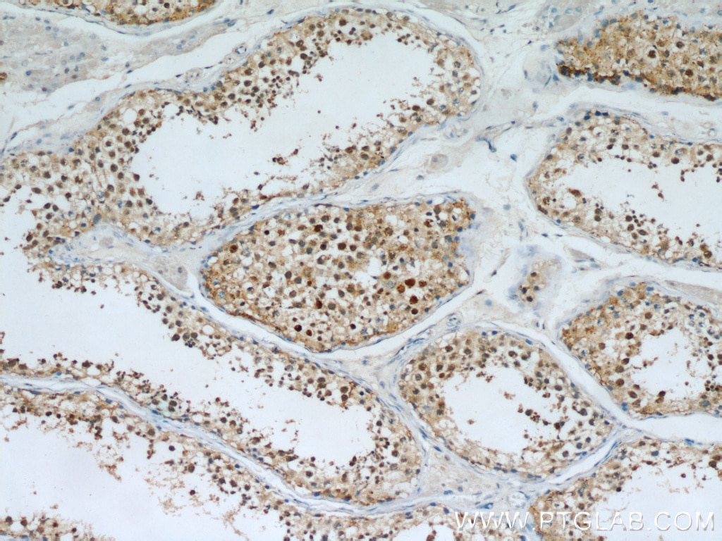 Immunohistochemistry (IHC) staining of human testis tissue using PI3 Kinase p110 Beta Polyclonal antibody (21739-1-AP)