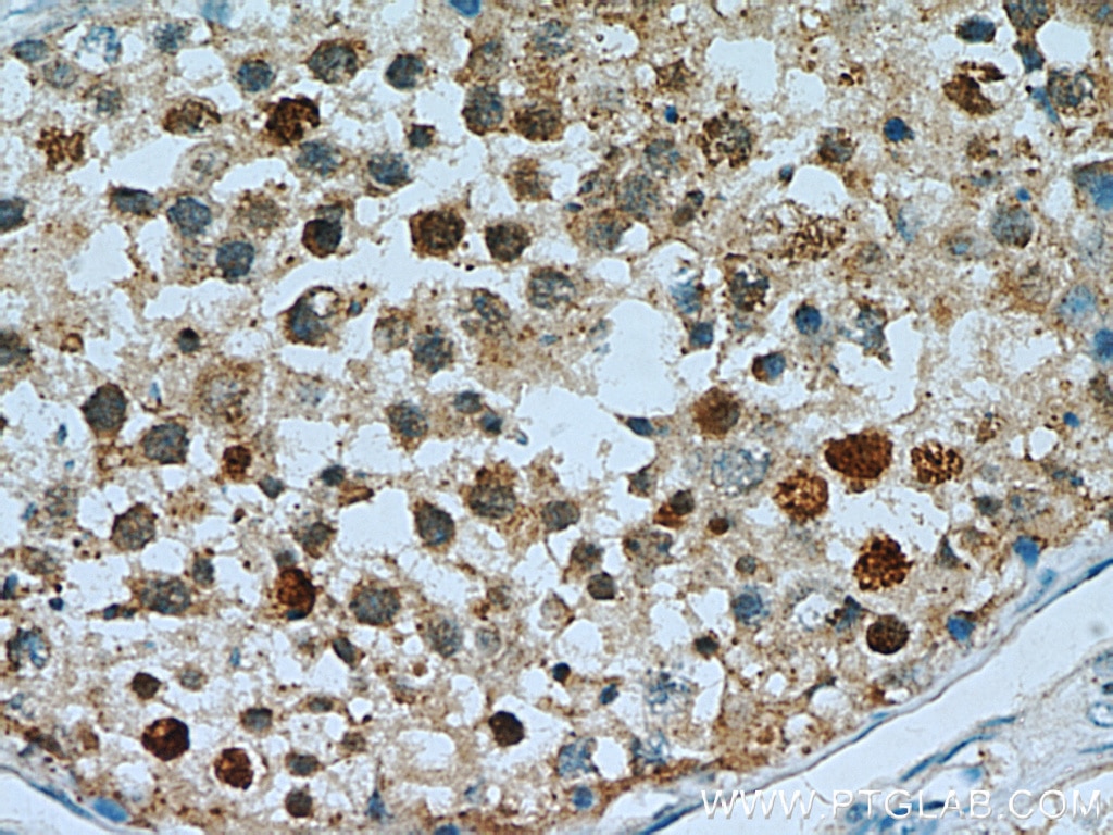 Immunohistochemistry (IHC) staining of human testis tissue using PI3 Kinase p110 Beta Polyclonal antibody (21739-1-AP)