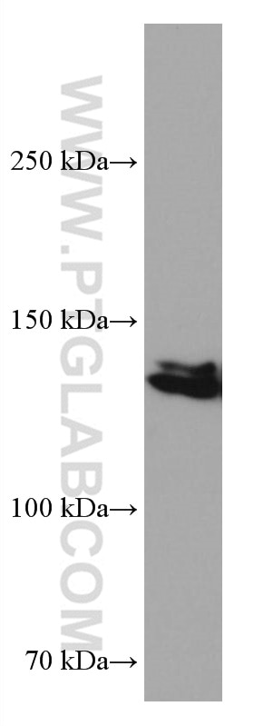 Western Blot (WB) analysis of HeLa cells using PI3 Kinase p110 Beta Monoclonal antibody (67121-1-Ig)