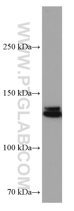 Western Blot (WB) analysis of HEK-293 cells using PI3 Kinase p110 Beta Monoclonal antibody (67121-1-Ig)
