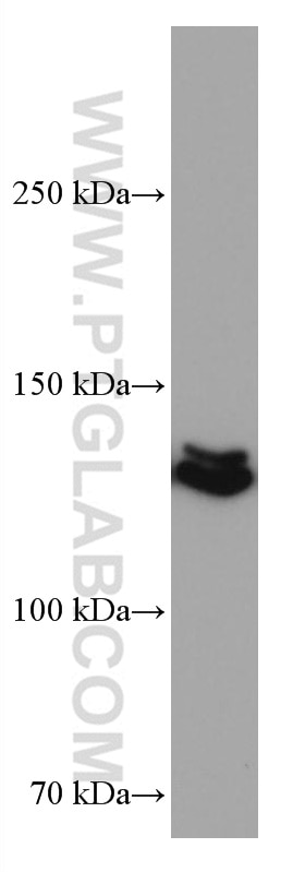 Western Blot (WB) analysis of MCF-7 cells using PI3 Kinase p110 Beta Monoclonal antibody (67121-1-Ig)