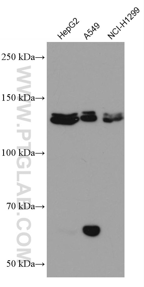 PI3 Kinase p110 Beta