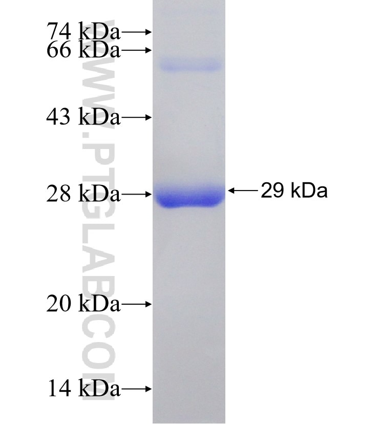 PIK3CB fusion protein Ag31056 SDS-PAGE PIK3CB fusion protein Ag31056 SDS-PAGE