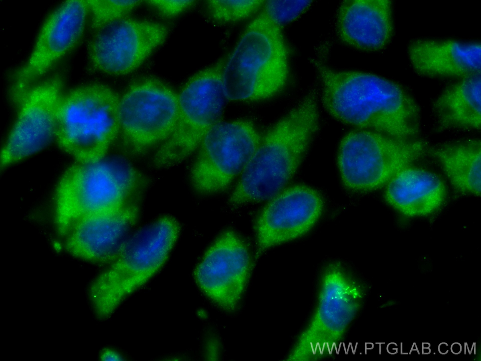 Immunofluorescence (IF) / fluorescent staining of LNCaP cells using PI3 Kinase p110 Delta Monoclonal antibody (67964-1-Ig)