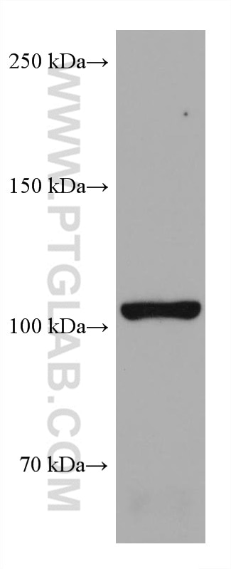 Western Blot (WB) analysis of LNCaP cells using PI3 Kinase p110 Delta Monoclonal antibody (67964-1-Ig)