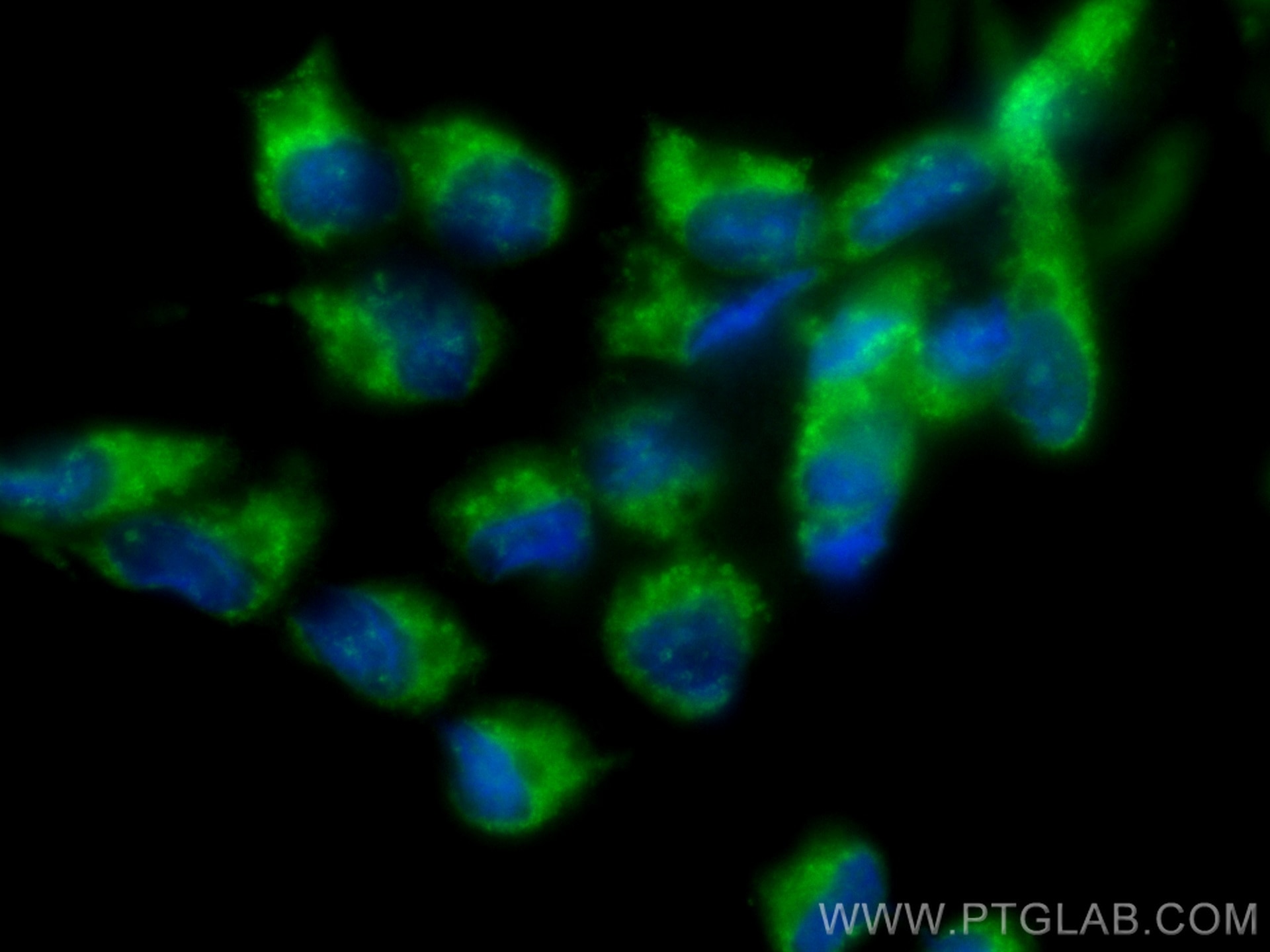 Immunofluorescence (IF) / fluorescent staining of LNCaP cells using CoraLite® Plus 488-conjugated PIK3CD Monoclonal an (CL488-67964)