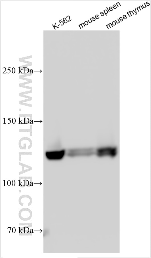 Western Blot (WB) analysis of various lysates using PIK3CG Polyclonal antibody (31229-1-AP)
