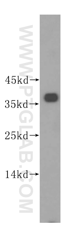 Western Blot (WB) analysis of HeLa cells using PIK3IP1 Polyclonal antibody (16826-1-AP)