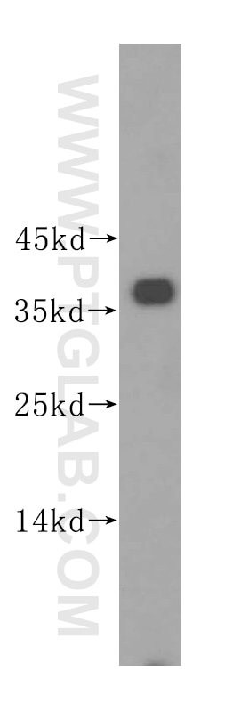 WB analysis of HeLa using 16826-1-AP