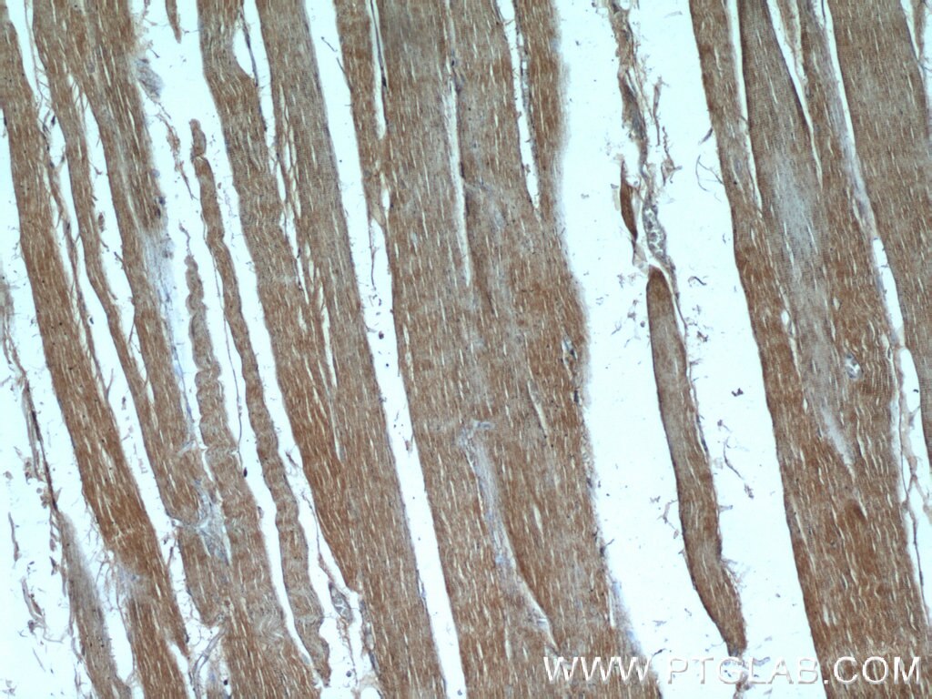 Immunohistochemistry (IHC) staining of human skeletal muscle tissue using PI3 Kinase p85 Alpha Monoclonal antibody (60225-1-Ig)