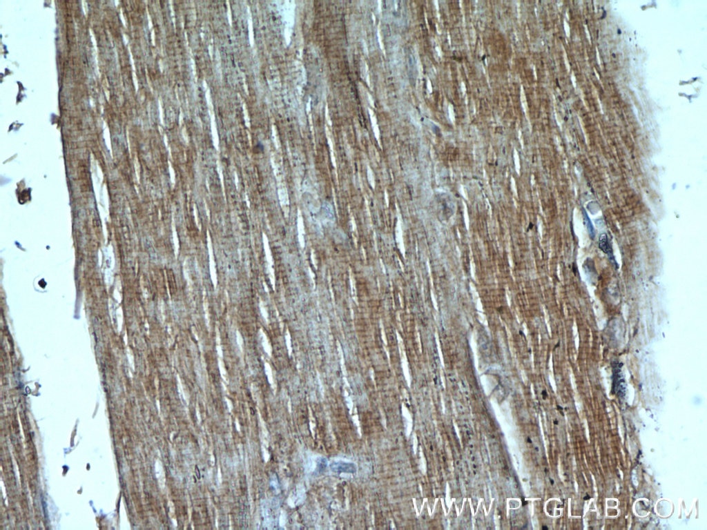 IHC staining of human skeletal muscle using 60225-1-Ig