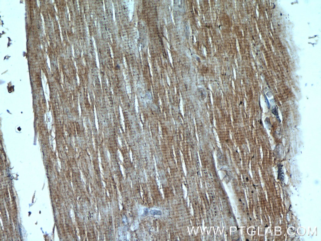 Immunohistochemistry (IHC) staining of human skeletal muscle tissue using PI3 Kinase p85 Alpha Monoclonal antibody (60225-1-Ig)