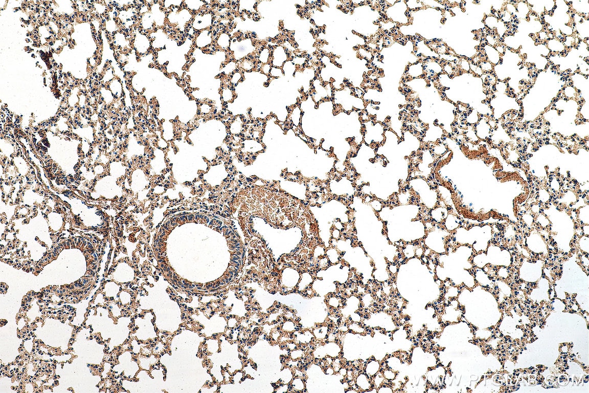 IHC staining of mouse lung using 60225-1-Ig