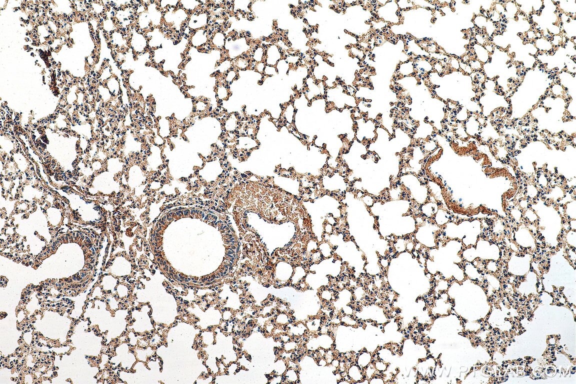 Immunohistochemistry (IHC) staining of mouse lung tissue using PI3 Kinase p85 Alpha Monoclonal antibody (60225-1-Ig)