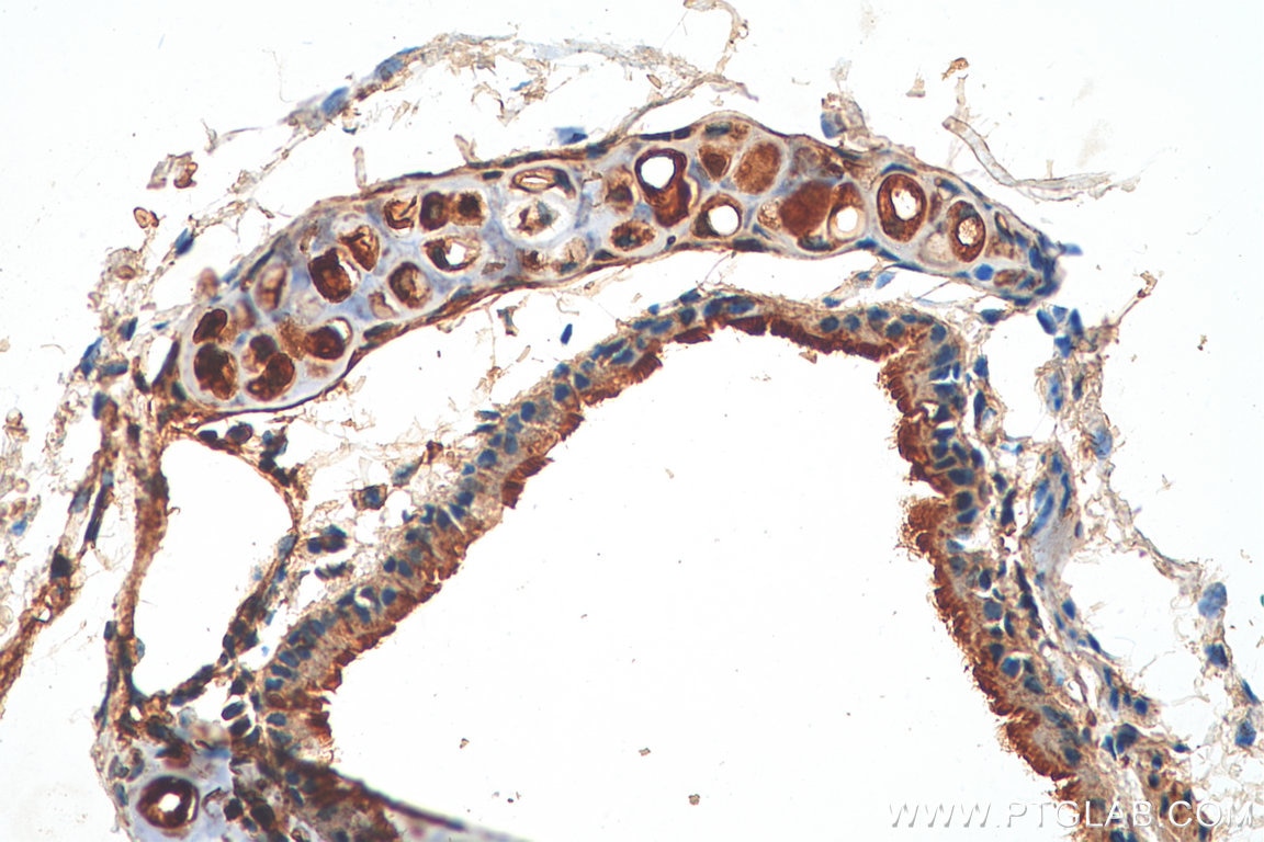 Immunohistochemistry (IHC) staining of mouse lung tissue using PI3 Kinase p85 Alpha Monoclonal antibody (60225-1-Ig)