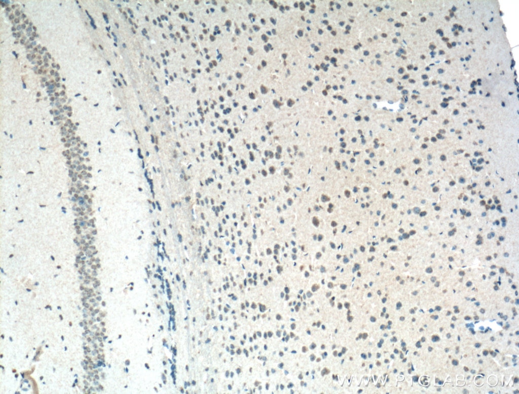 Immunohistochemistry (IHC) staining of mouse brain tissue using PI3 Kinase p85 Alpha Monoclonal antibody (60225-1-Ig)