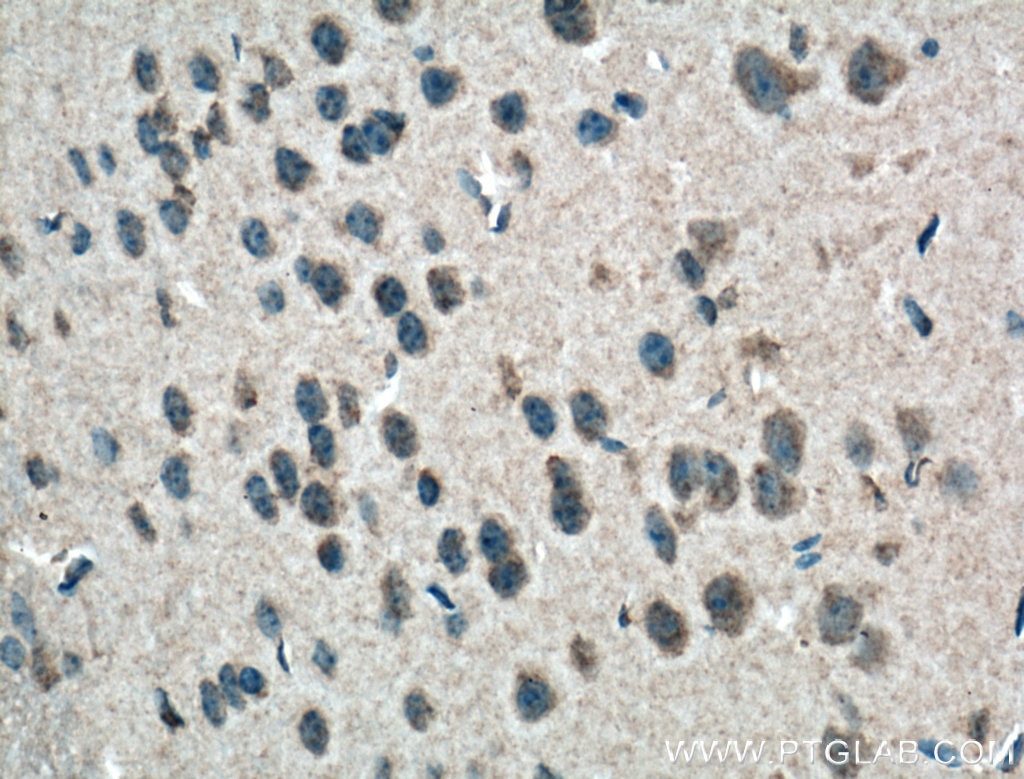 Immunohistochemistry (IHC) staining of mouse brain tissue using PI3 Kinase p85 Alpha Monoclonal antibody (60225-1-Ig)