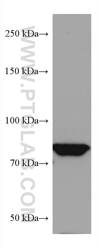 Western Blot (WB) analysis of Jurkat cells using PI3 Kinase p85 Alpha Monoclonal antibody (60225-1-Ig)