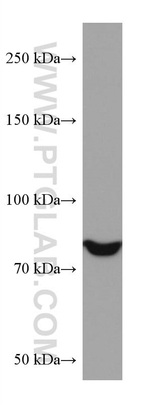 Western Blot (WB) analysis of A549 cells using PI3 Kinase p85 Alpha Monoclonal antibody (60225-1-Ig)