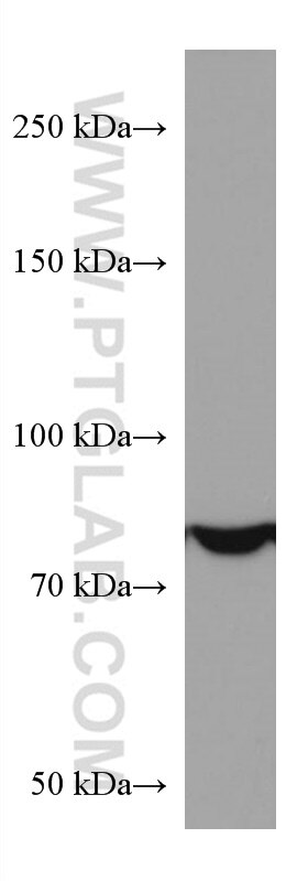 Western Blot (WB) analysis of HEK-293 cells using PI3 Kinase p85 Alpha Monoclonal antibody (60225-1-Ig)