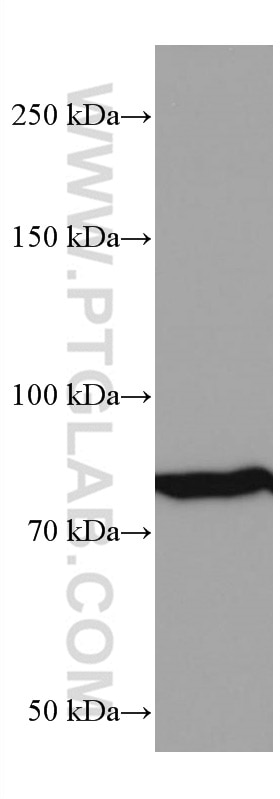 Western Blot (WB) analysis of Neuro-2a cells using PI3 Kinase p85 Alpha Monoclonal antibody (60225-1-Ig)