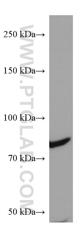 Western Blot (WB) analysis of PC-12 cells using PI3 Kinase p85 Alpha Monoclonal antibody (60225-1-Ig)