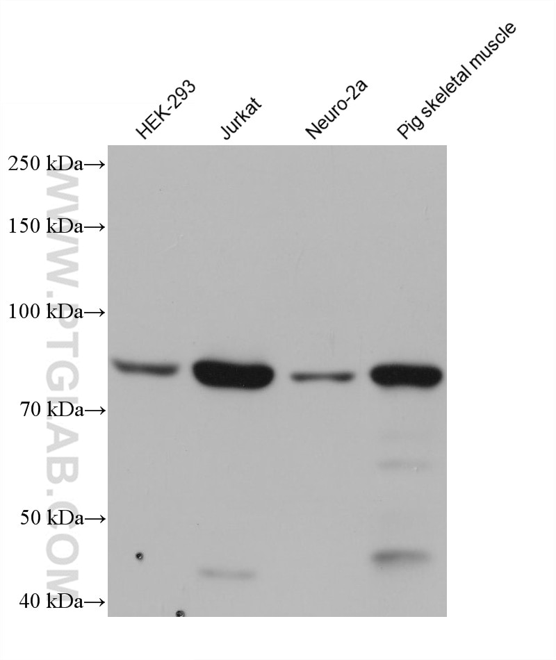 Western Blot (WB) analysis of various lysates using PI3 Kinase p85 Alpha Monoclonal antibody (60225-1-Ig)