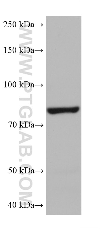 Western Blot (WB) analysis of rabbit brain tissue using PI3 Kinase p85 Alpha Monoclonal antibody (60225-1-Ig)