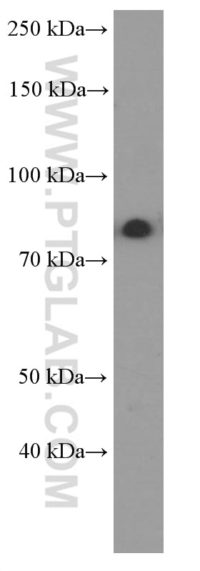 Western Blot (WB) analysis of rat brain tissue using PI3 Kinase p85 Alpha Monoclonal antibody (60225-1-Ig)