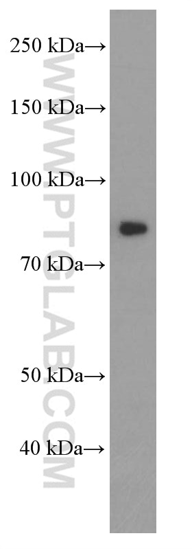 Western Blot (WB) analysis of fetal human brain tissue using PI3 Kinase p85 Alpha Monoclonal antibody (60225-1-Ig)