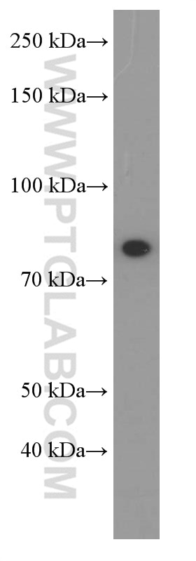 Western Blot (WB) analysis of mouse brain tissue using PI3 Kinase p85 Alpha Monoclonal antibody (60225-1-Ig)