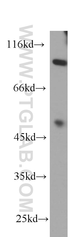 PI3 Kinase p85 Alpha Monoclonal antibody