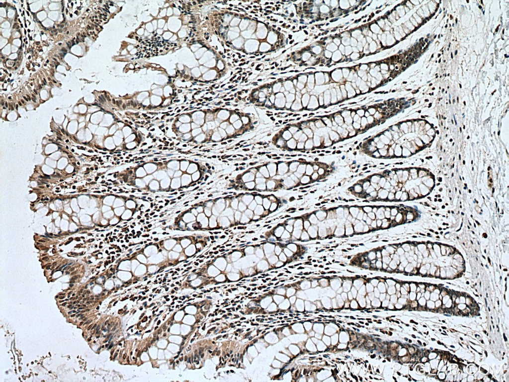 Immunohistochemistry (IHC) staining of human colon tissue using PI3 Kinase p85 Beta Monoclonal antibody (67644-1-Ig)